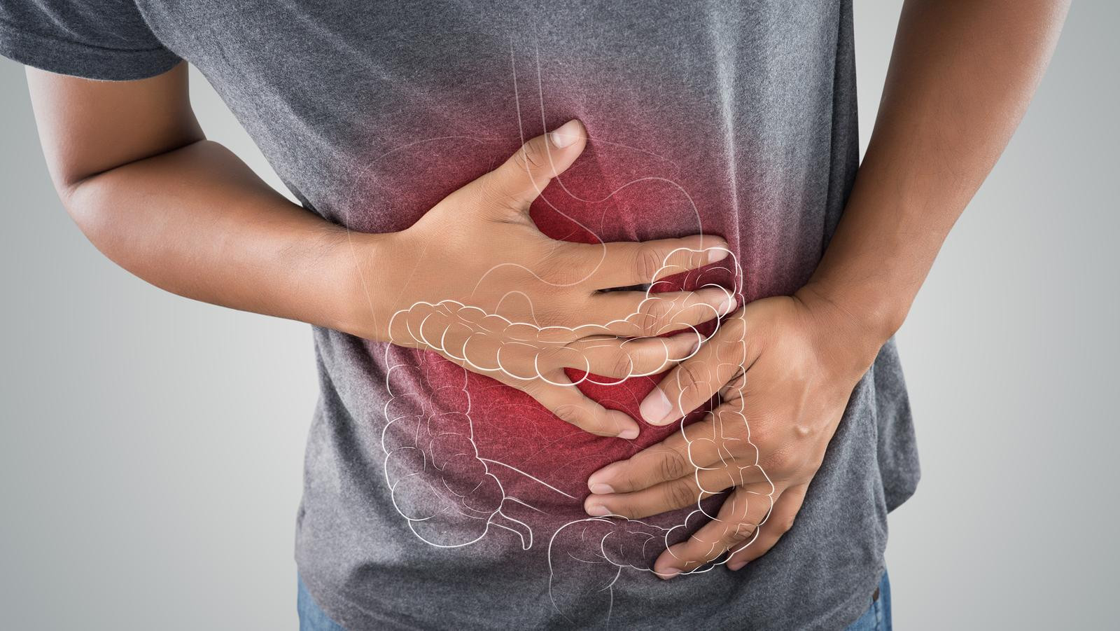 Vastagbél és végbél rák