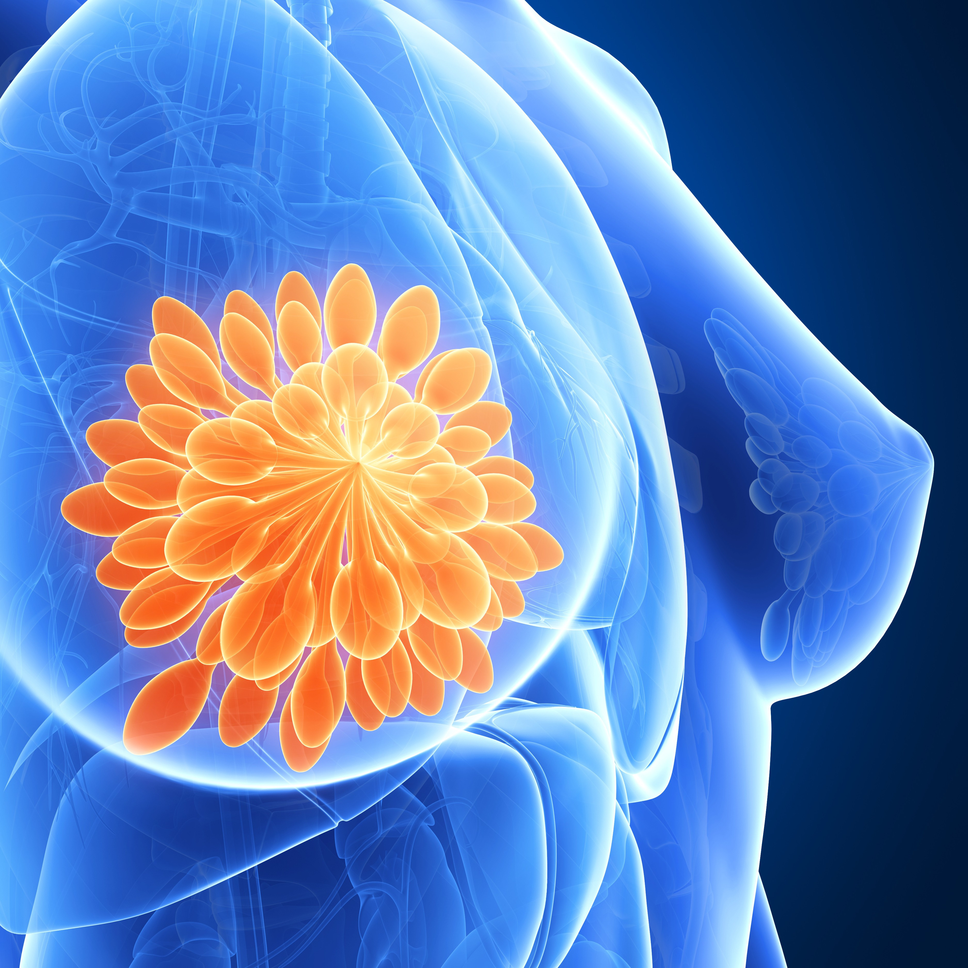 Az emlőrák molekuláris diagnosztikája